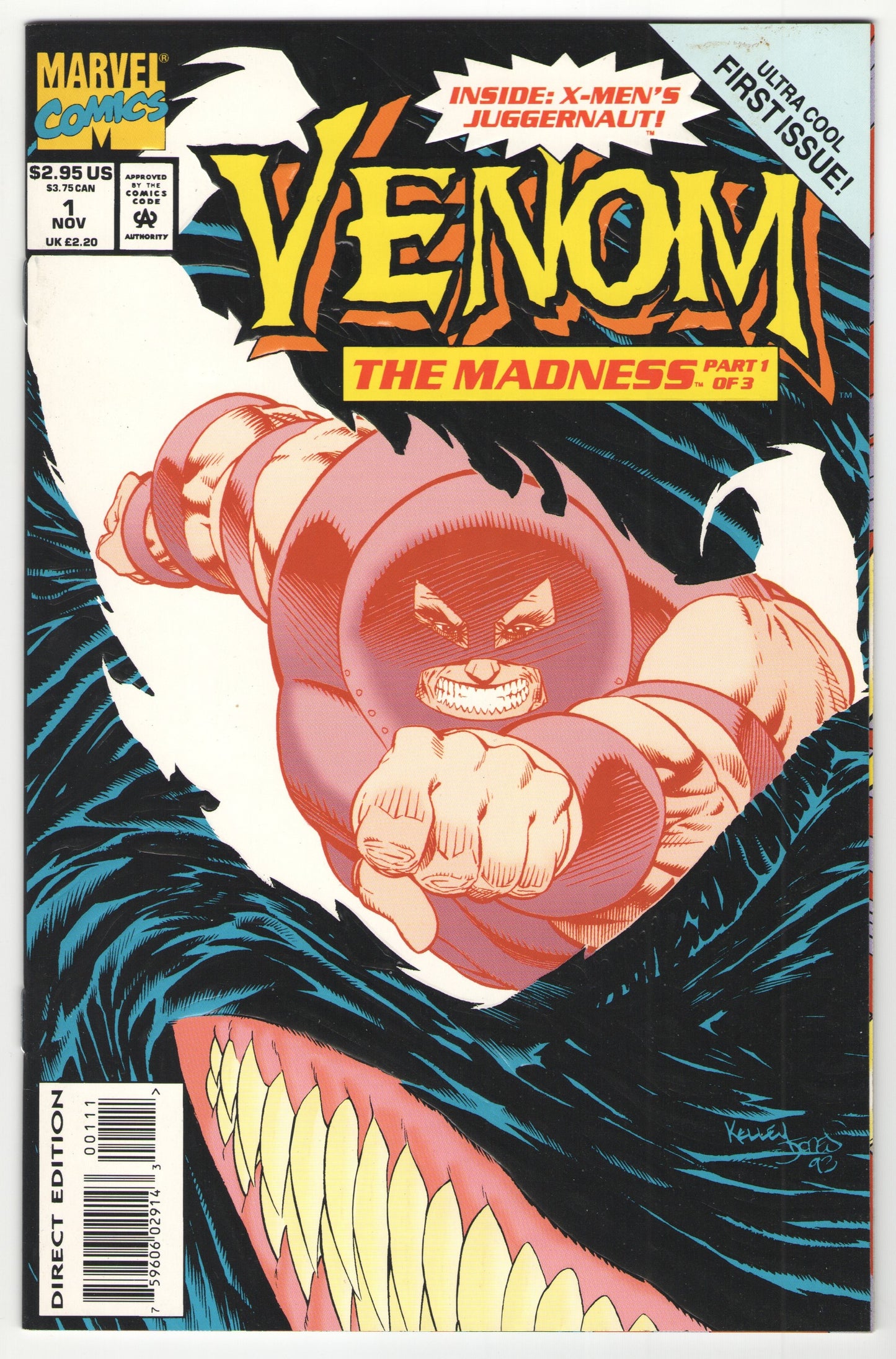 Venom: The Madness (1993) Complete Limited Series